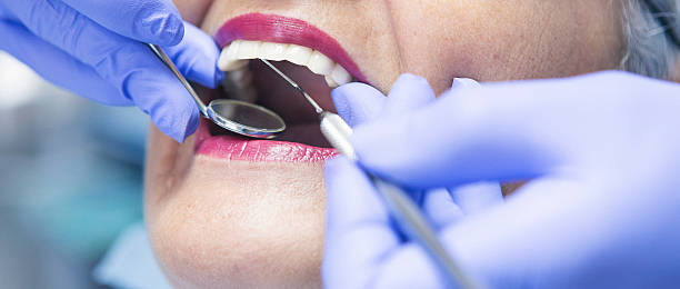 Best Root Canal Emergency Dentist  in Meeker, CO